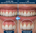 GumRenew Pro - טיפול אור אקטיבי בחניכיים ב-12 דקות ביום